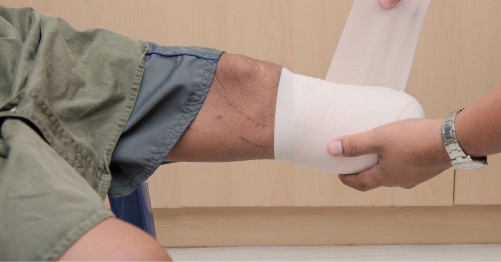 Opatrunek na kikut po amputacji kończyny dolnej zakładany podczas pielęgnacji i gojenia rany